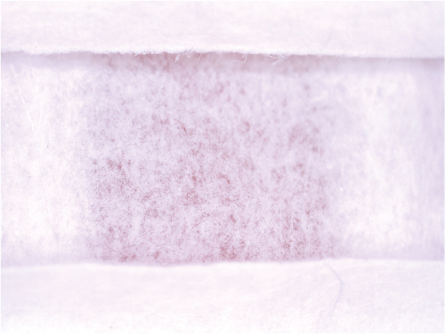 フィルター拡大